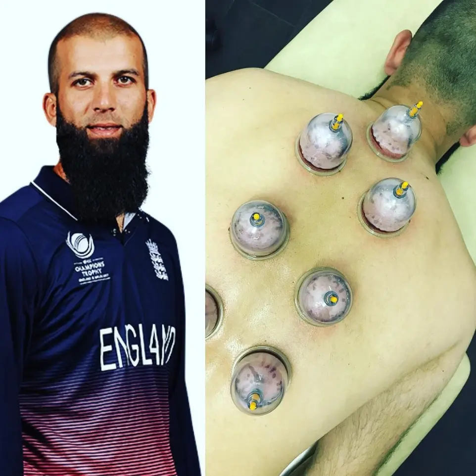 Hashim Amla Hijama