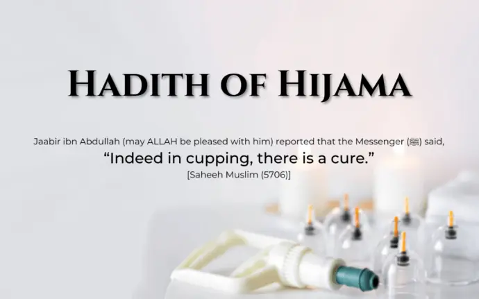 Hadith on Hijama